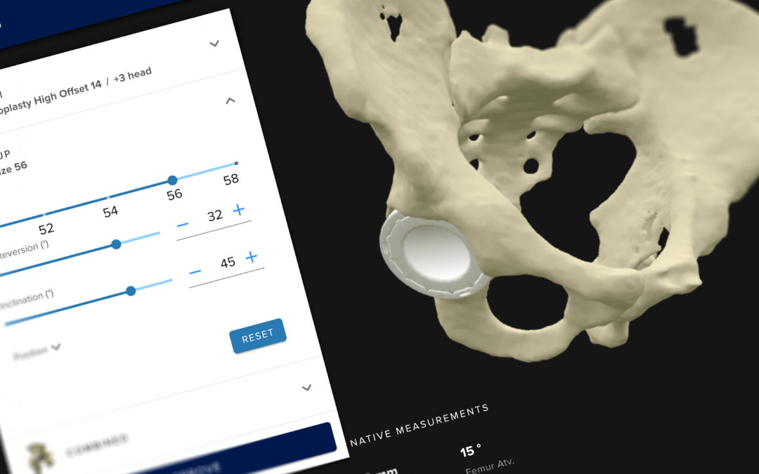 Alumni venture FormusLabs raises $5m towards AI powered orthopaedic surgery software